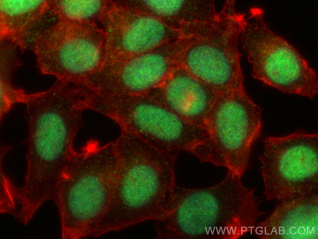 PCYT1A Antibody in Immunocytochemistry (ICC/IF)