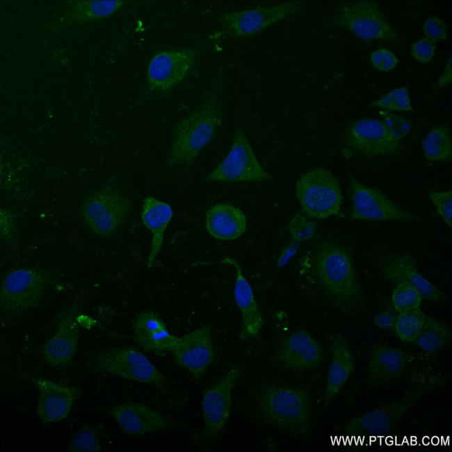 ODC1 Antibody in Immunocytochemistry (ICC/IF)