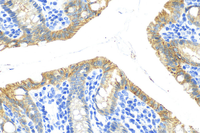 ZO-2 Antibody in Immunohistochemistry (Paraffin) (IHC (P))