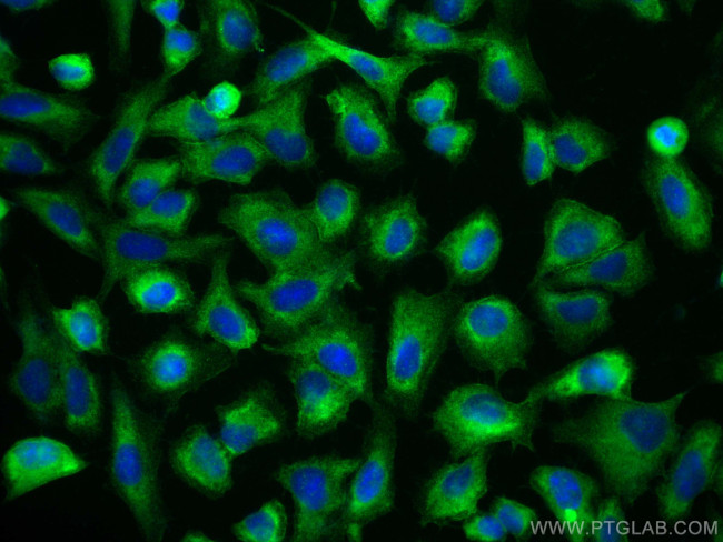 NEDD4 Antibody in Immunocytochemistry (ICC/IF)
