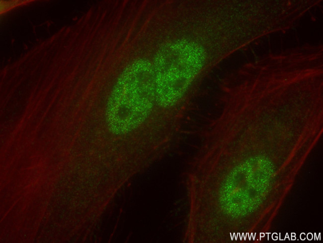 OGT Antibody in Immunocytochemistry (ICC/IF)