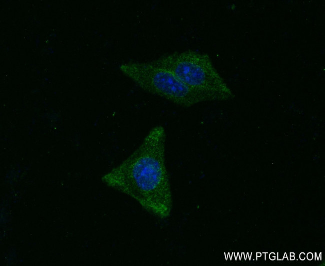 MMP1 Antibody in Immunocytochemistry (ICC/IF)