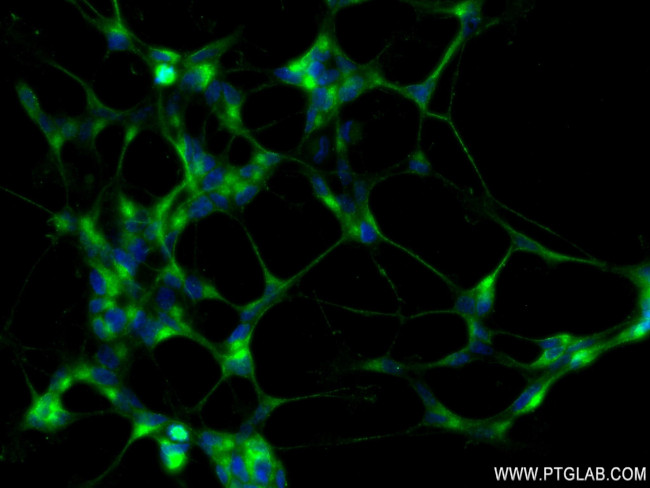 CELSR2 Antibody in Immunocytochemistry (ICC/IF)