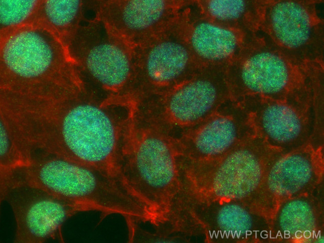 NSD3 Antibody in Immunocytochemistry (ICC/IF)
