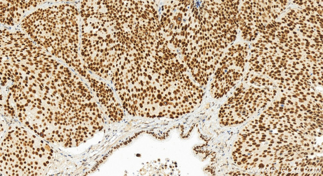 NSD3 Antibody in Immunohistochemistry (Paraffin) (IHC (P))