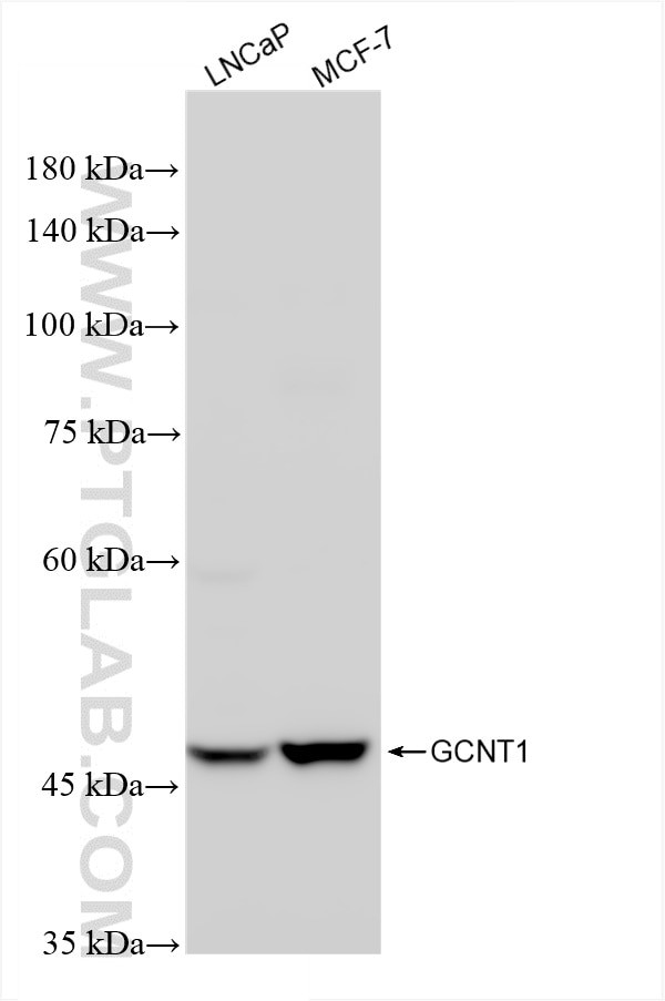 GCNT1 Antibody in Western Blot (WB)