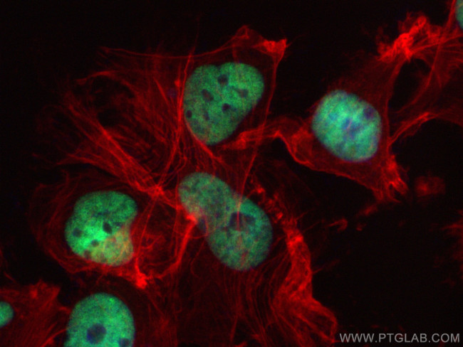 HNRPDL Antibody in Immunocytochemistry (ICC/IF)