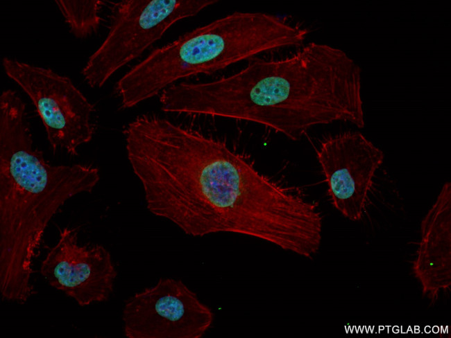JUND Antibody in Immunocytochemistry (ICC/IF)