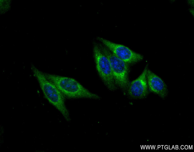 RNF31/HOIP Antibody in Immunocytochemistry (ICC/IF)