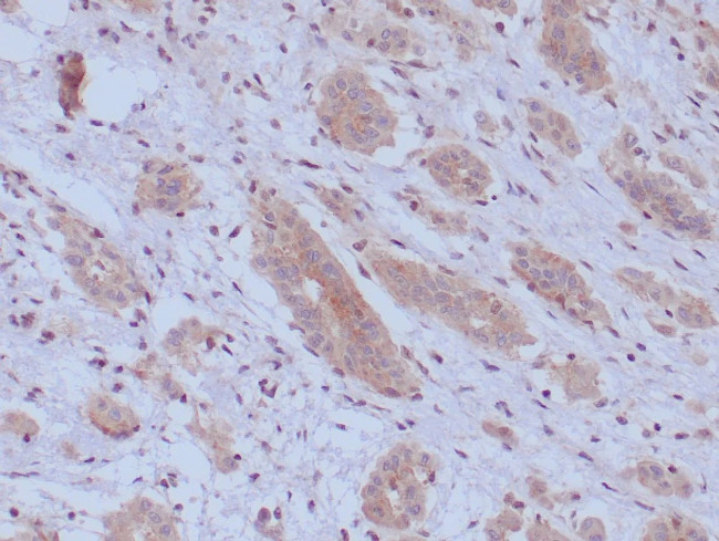 BAP1 (BRCA1 Associated Protein 1) Antibody in Immunohistochemistry (Paraffin) (IHC (P))