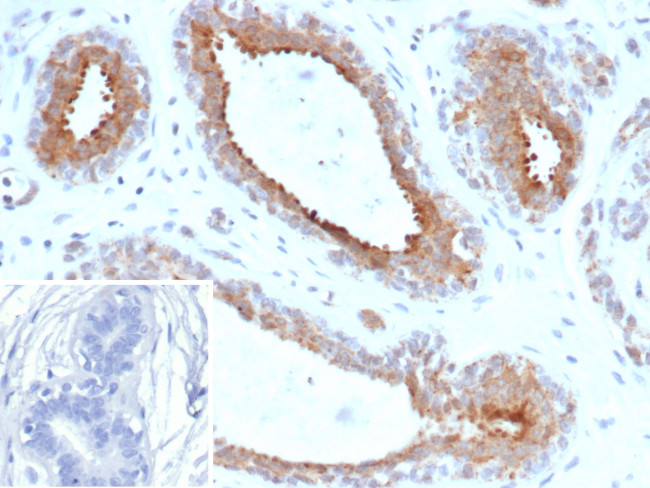 BAP1 (BRCA1 Associated Protein 1) Antibody in Immunohistochemistry (Paraffin) (IHC (P))