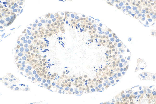 MDM1 Antibody in Immunohistochemistry (Paraffin) (IHC (P))