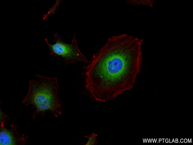 GRP94 Antibody in Immunocytochemistry (ICC/IF)