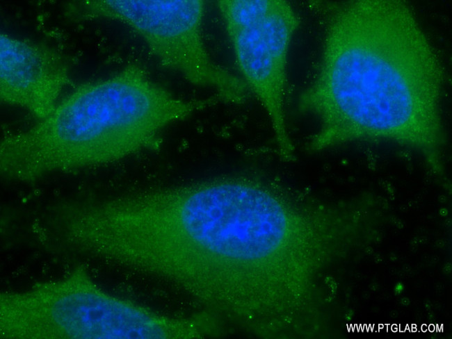 TIMP1 Antibody in Immunocytochemistry (ICC/IF)