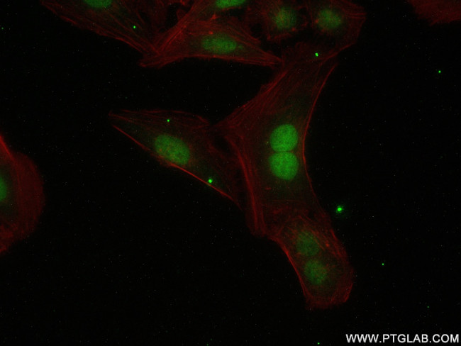 INTS5 Antibody in Immunocytochemistry (ICC/IF)