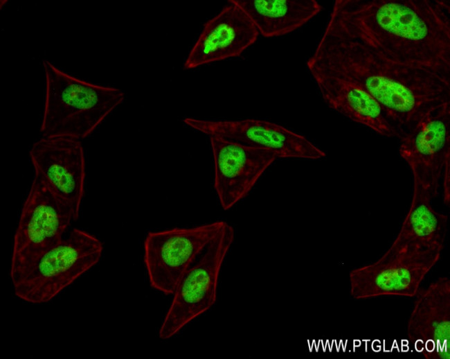 HOXB6 Antibody in Immunocytochemistry (ICC/IF)
