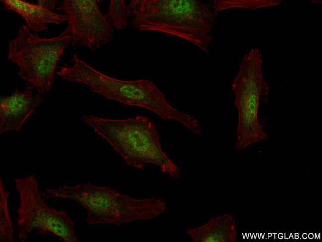 IFI35 Antibody in Immunocytochemistry (ICC/IF)