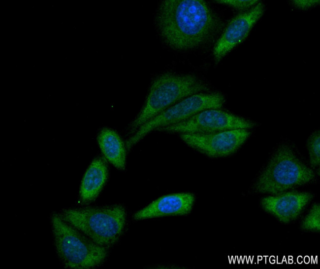 TYK2 Antibody in Immunocytochemistry (ICC/IF)
