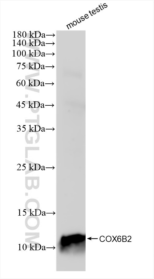 COX6B2 Antibody in Western Blot (WB)