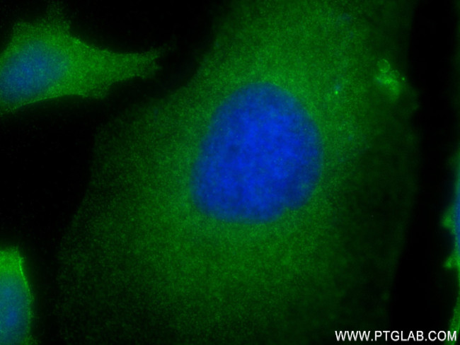 ROCK1 Antibody in Immunocytochemistry (ICC/IF)