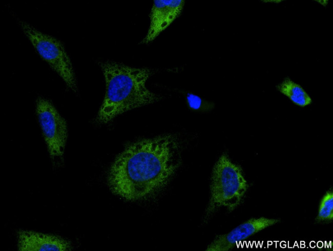 TGFB2 Antibody in Immunocytochemistry (ICC/IF)