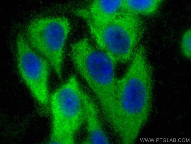 SAR1A Antibody in Immunocytochemistry (ICC/IF)
