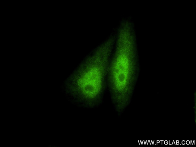 SMAD4 Antibody in Immunocytochemistry (ICC/IF)