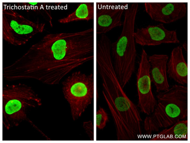 Acetyl-Histone H2B (Lys5) Antibody in Immunocytochemistry (ICC/IF)