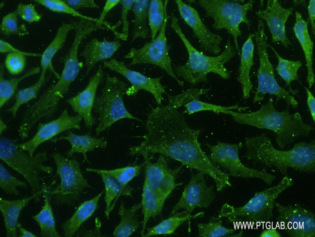 PRKD1 Antibody in Immunocytochemistry (ICC/IF)