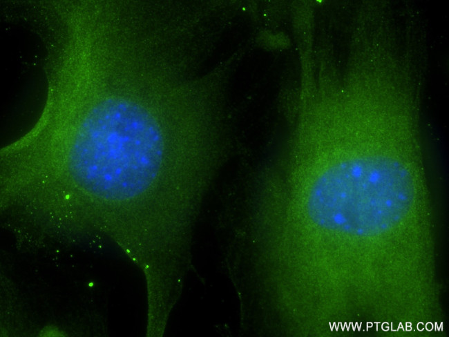 TRIM54 Antibody in Immunocytochemistry (ICC/IF)