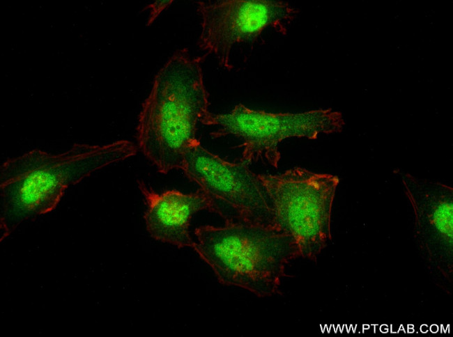 TPR Antibody in Immunocytochemistry (ICC/IF)