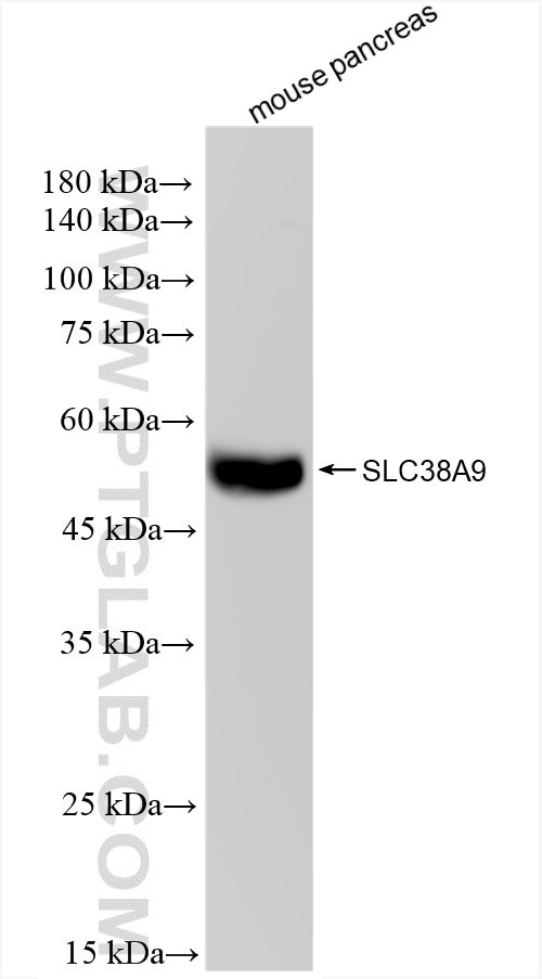 SLC38A9 Antibody in Western Blot (WB)