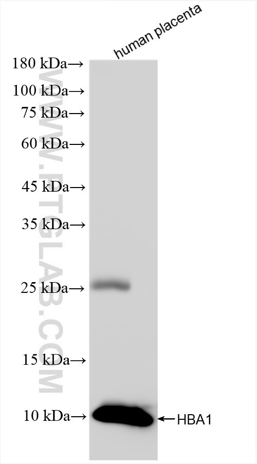 HBA1 Antibody in Western Blot (WB)