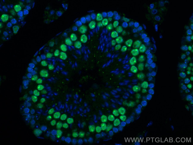 SMC6 Antibody in Immunohistochemistry (PFA fixed) (IHC (PFA))