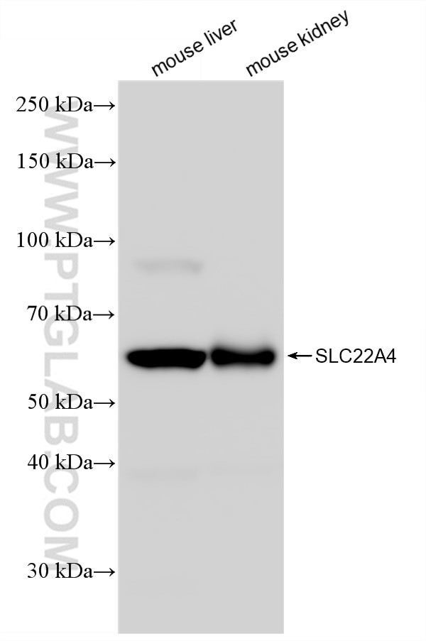 SLC22A4 Antibody in Western Blot (WB)