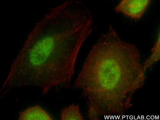 HIRA Antibody in Immunocytochemistry (ICC/IF)