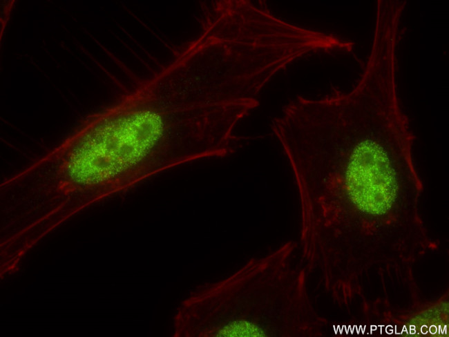 TFAP4 Antibody in Immunocytochemistry (ICC/IF)