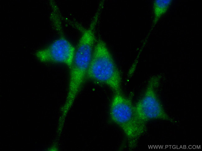 MIF Antibody in Immunocytochemistry (ICC/IF)