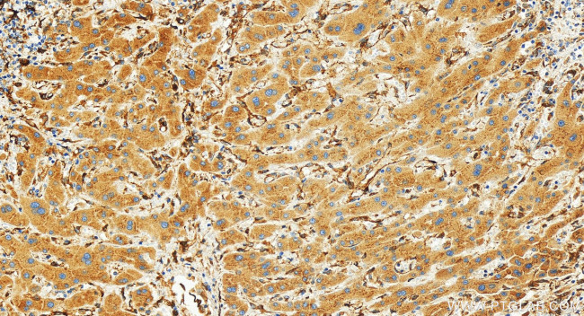 IGFBP4 Antibody in Immunohistochemistry (Paraffin) (IHC (P))