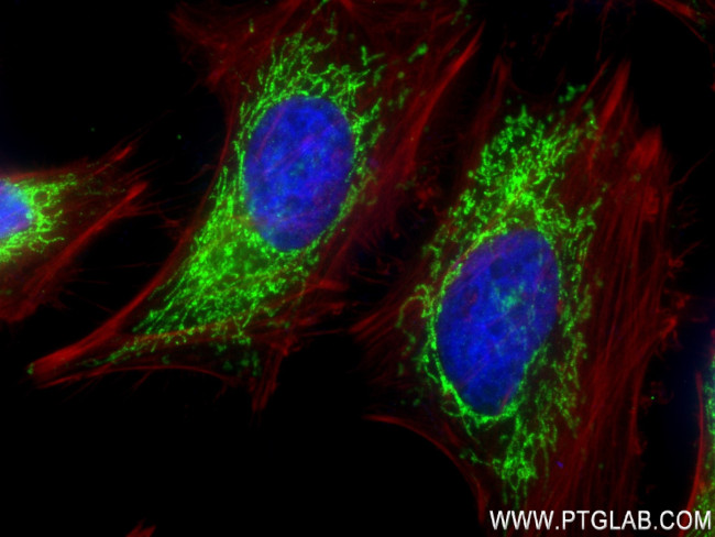 ATP6 Antibody in Immunocytochemistry (ICC/IF)