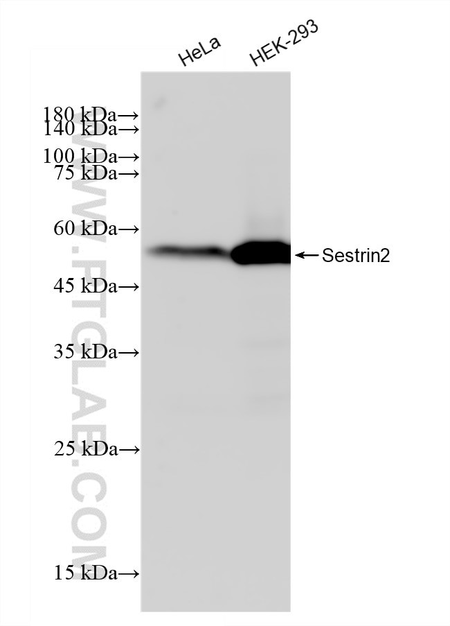 Sestrin 2 Antibody in Western Blot (WB)
