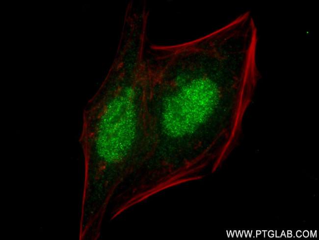 CBP80 Antibody in Immunocytochemistry (ICC/IF)