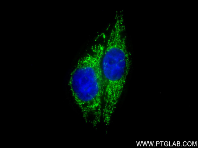 NDUFB8 Antibody in Immunocytochemistry (ICC/IF)