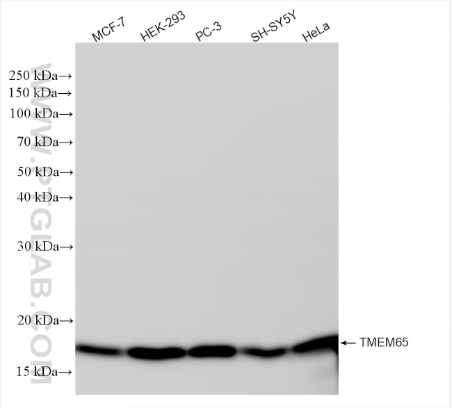 TMEM65 Antibody in Western Blot (WB)