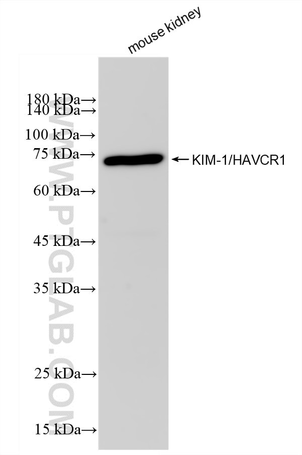 KIM-1/HAVCR1 Antibody in Western Blot (WB)