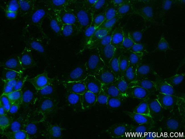 Nectin-4/PVRL4 Antibody in Immunocytochemistry (ICC/IF)