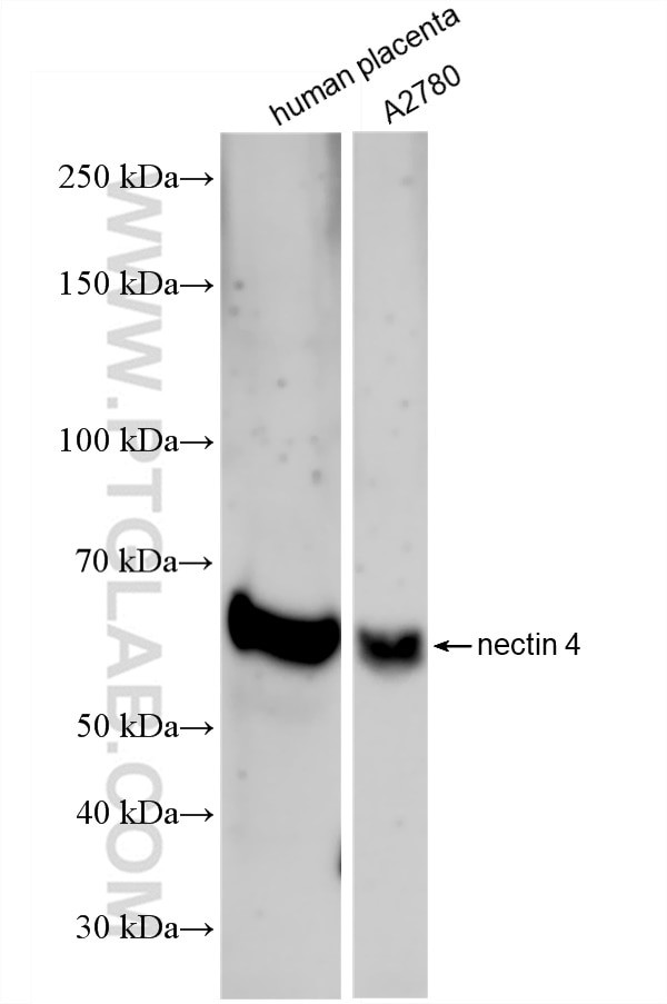 Nectin-4/PVRL4 Antibody in Western Blot (WB)