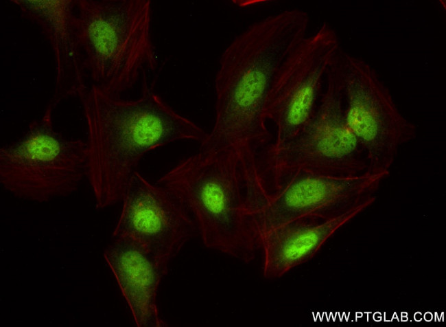 SLC12A8 Antibody in Immunocytochemistry (ICC/IF)