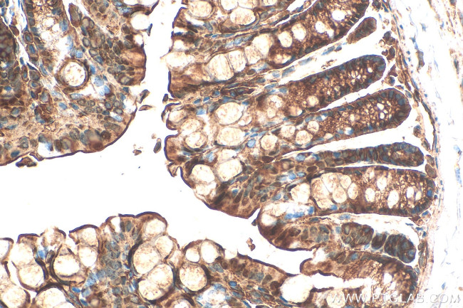 SULT1B1 Antibody in Immunohistochemistry (Paraffin) (IHC (P))