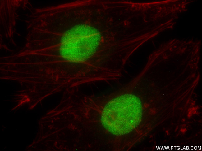 MLLT1 Antibody in Immunocytochemistry (ICC/IF)